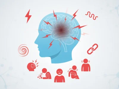 Profil d'une tête bleue avec éclairs rouges et icônes représentant le symptôme tumeur au cerveau