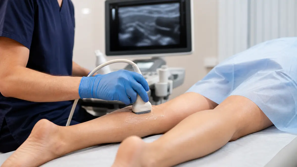 Examen de doppler veineux du mollet en cabinet medical.