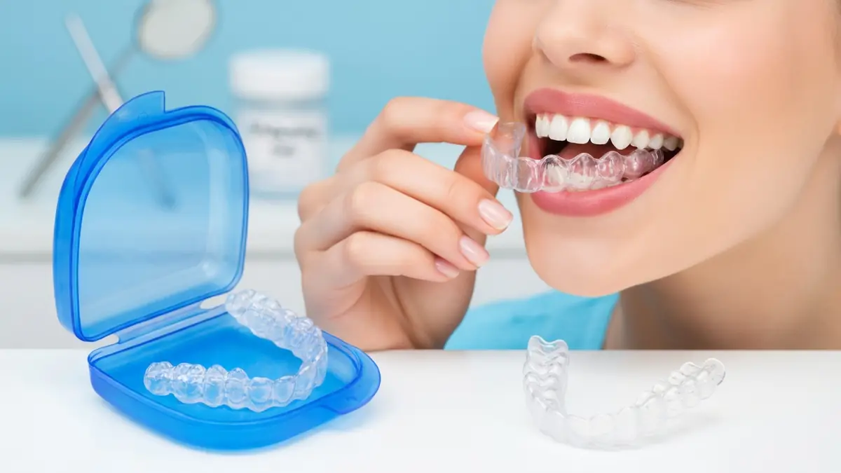 Une femme sourit en plaçant une gouttière dentaire transparente sur ses dents devant un boîtier de rangement bleu